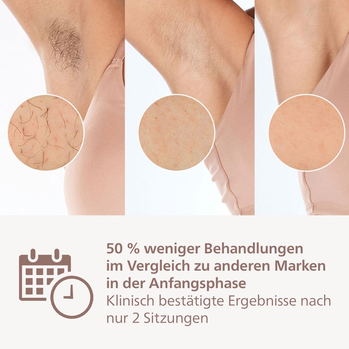 Philips Lumea IPL Series 8000 – IPL-Gerät zur Haarentfernung, Alternative zur Laser-Haarentfernung