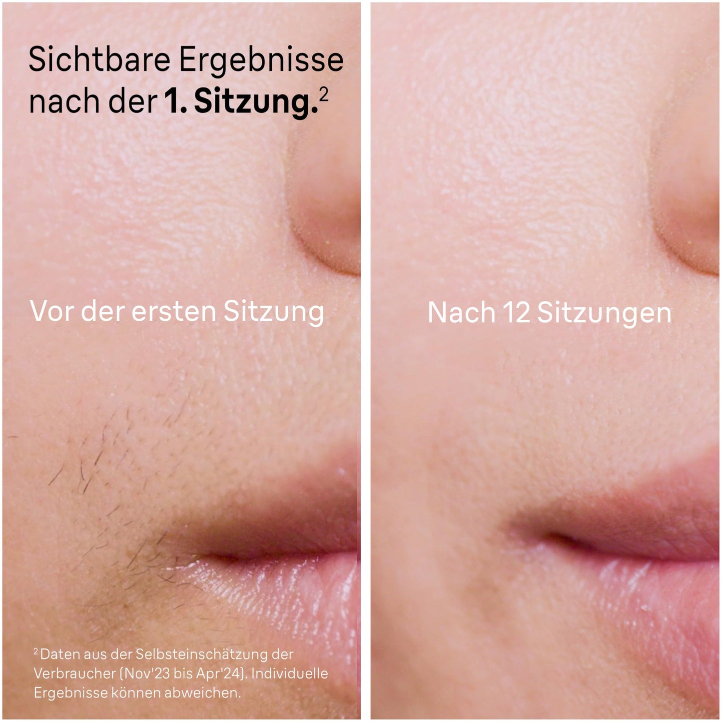 Braun Smart IPL 7 Skin i·expert – IPL Geräte Haarentfernung, Dauerhafte und Schmerzfreie Haarentfernung für Zuhause