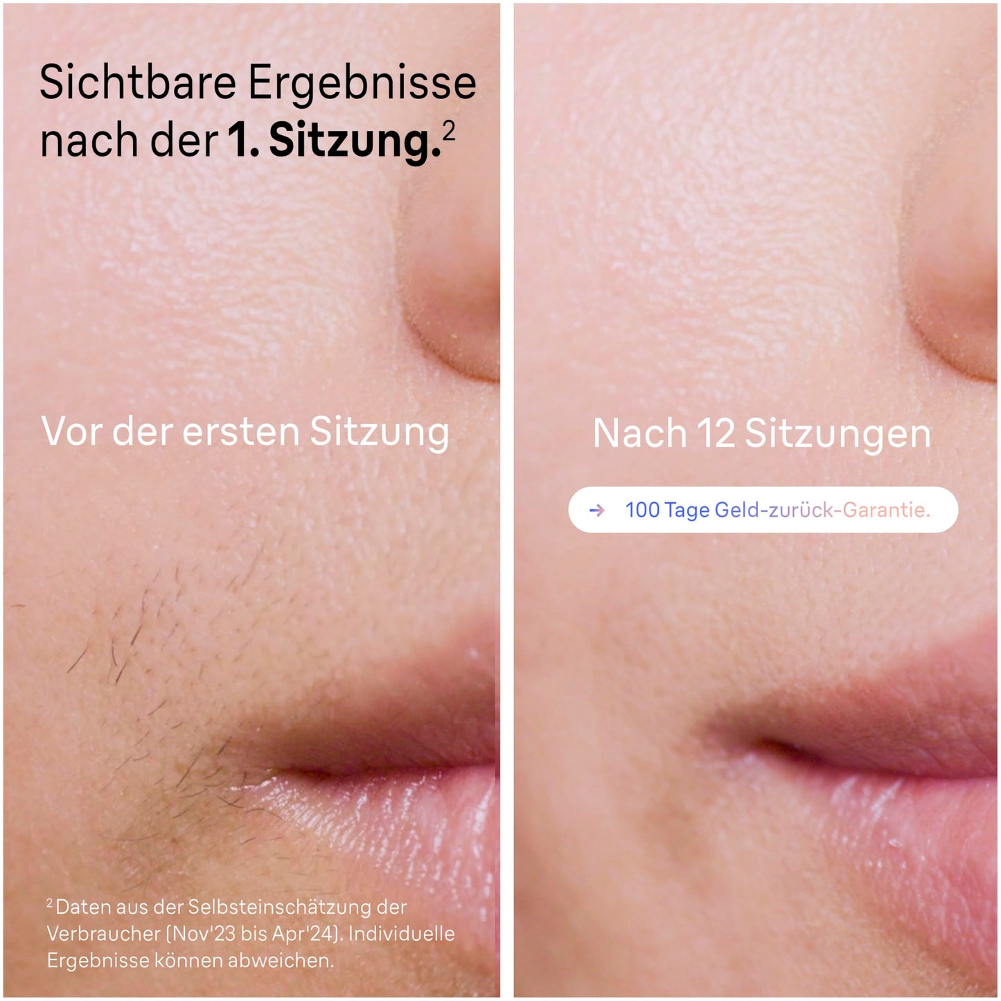 Braun Smart IPL 7 Skin i·expert – IPL Geräte Haarentfernung, Dauerhafte und Schmerzfreie Haarentfernung für Zuhause